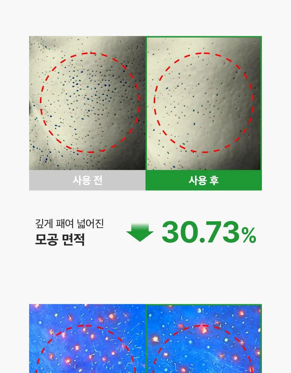 [모공딥클렌징] 성분에디터 그린토마토 딥 포어 클렌징 울트라 휘핑 폼 120g 상세페이지 46